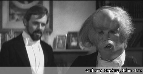 The Elephant Man - 3