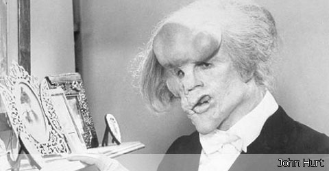 The Elephant Man - 1
